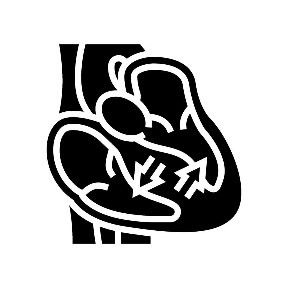 hypertrophic cardiomyopathy cardiology glyph icon illustration vector