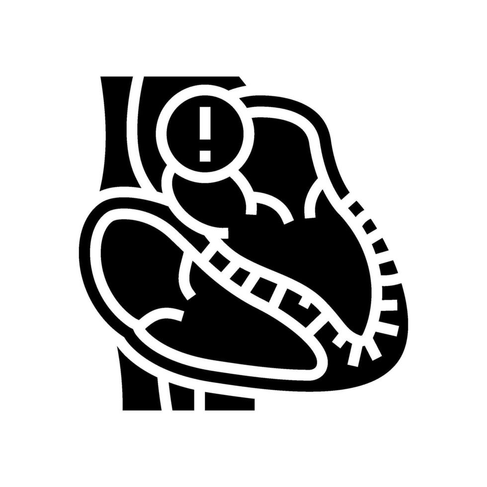 restrictive cardiomyopathy cardiology glyph icon illustration vector