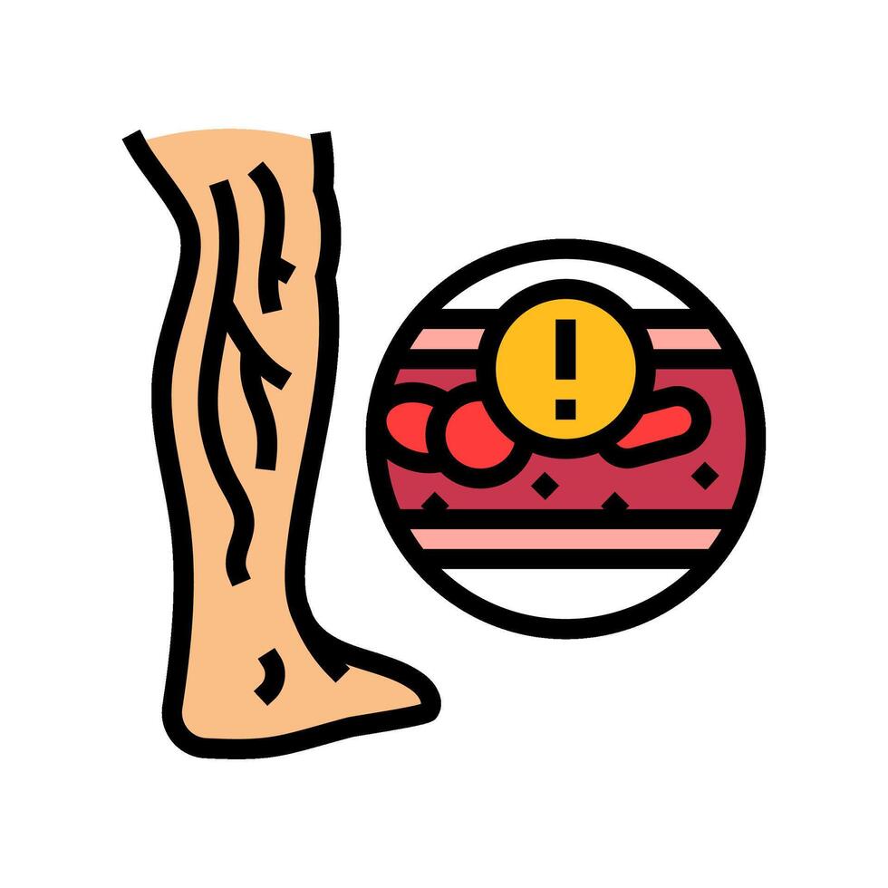deep vein thrombosis cardiology disease color icon illustration vector