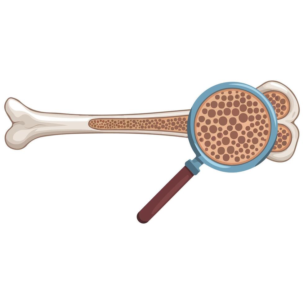 Bone Health Osteoporosis Illustration vector