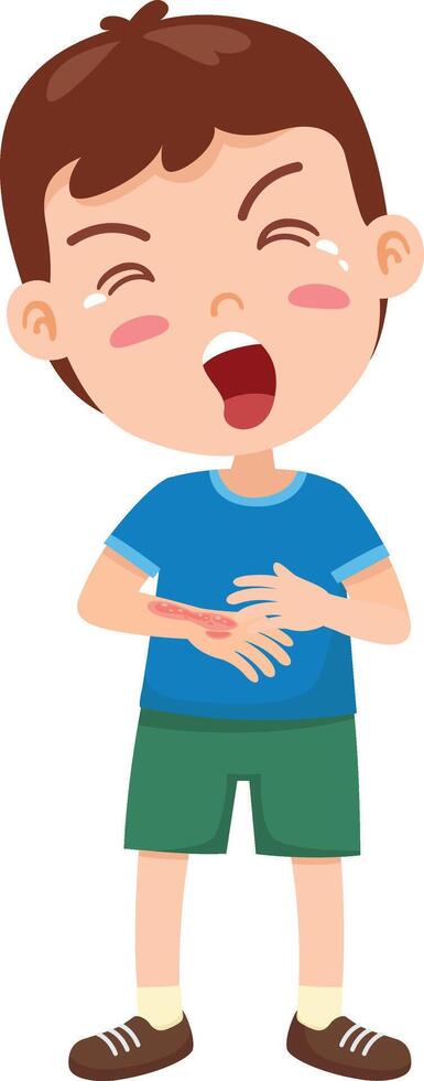 Burn of hand child skin illustration vector