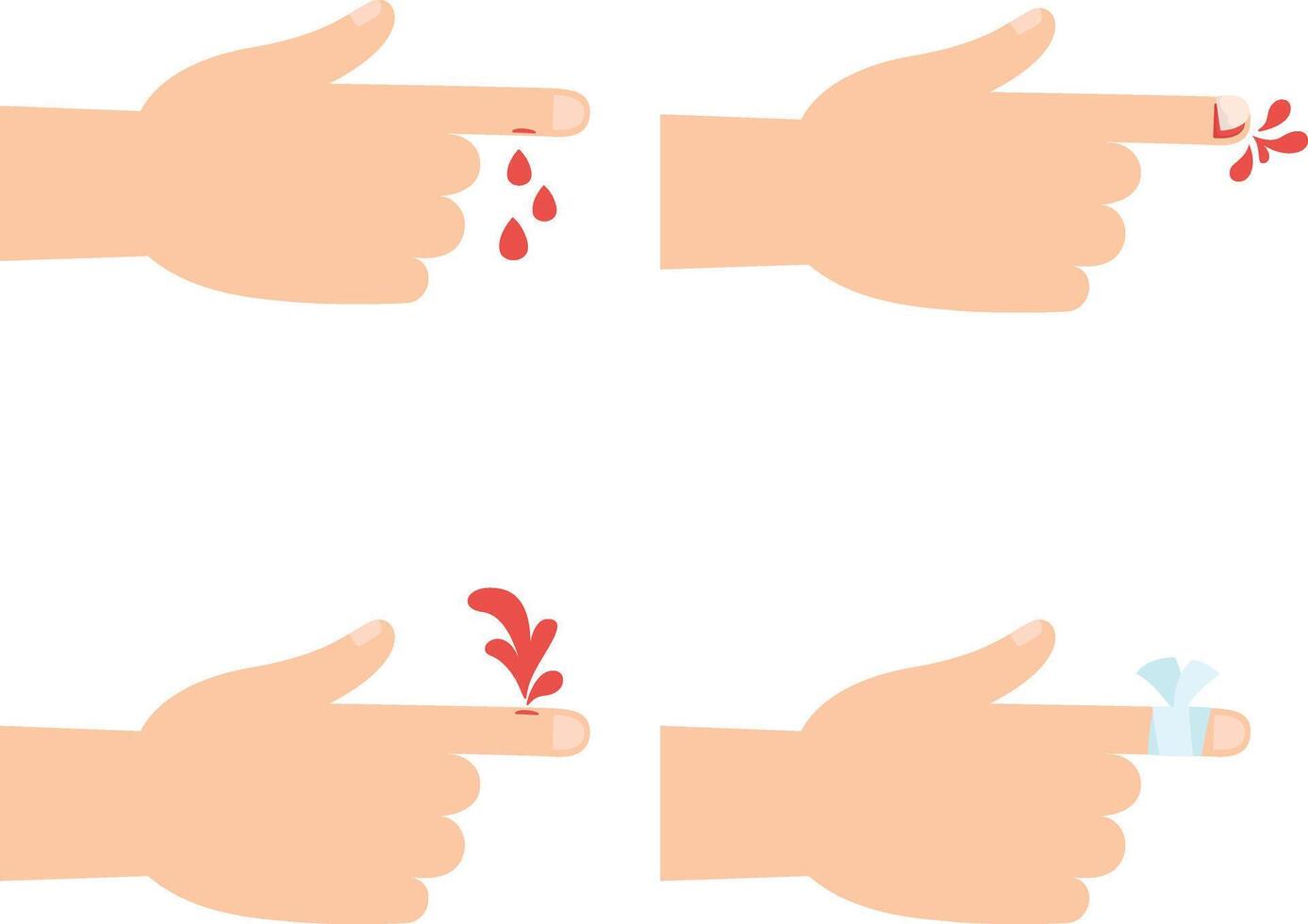 Set of injure hand illustration vector