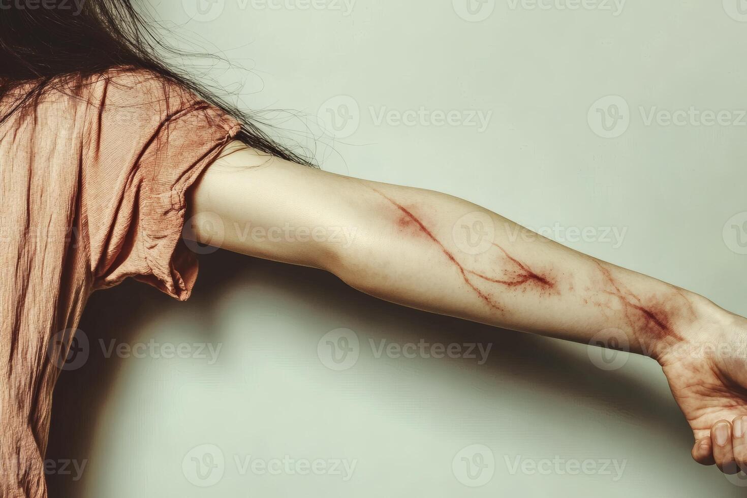 Person with scratched arm showing deep marks against a neutral background in a dimly lit setting photo