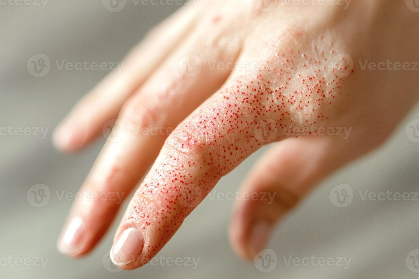 Close-up view of skin irritation with red spots on a hand indicating possible allergic reaction or irritation photo