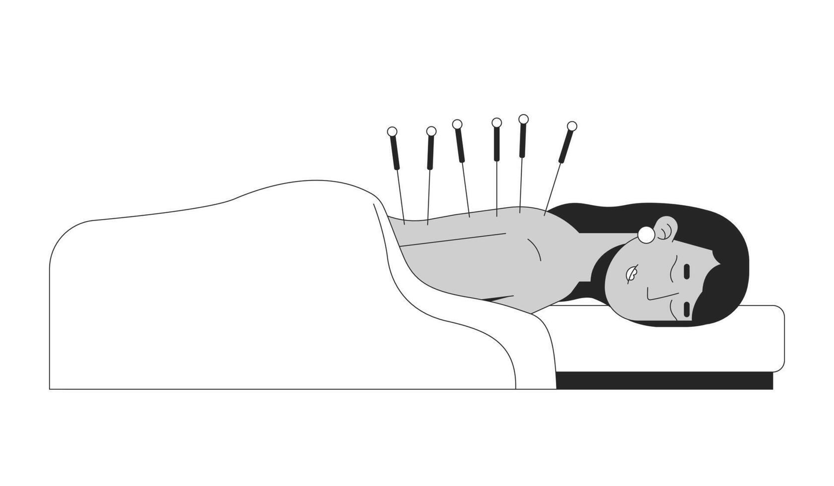 South asian woman receiving acupuncture therapy 2D line character. Indian female lying on massage table under blanket with needles isolated ink outline person. Monochromatic spot illustration vector
