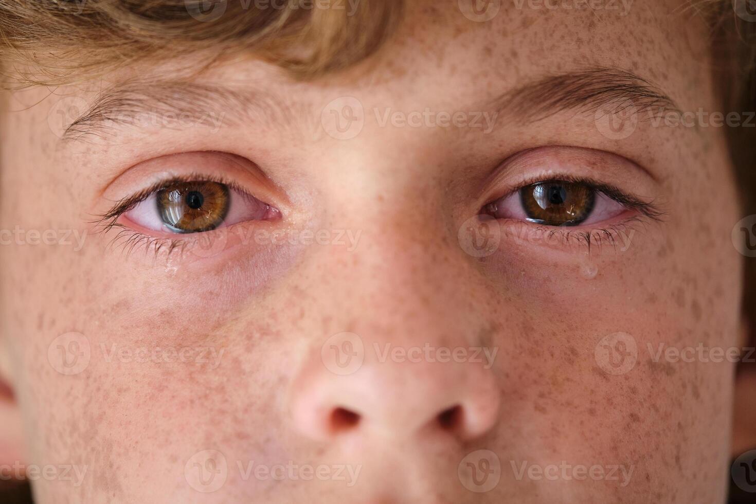 Crop crying child with freckles on face skin photo