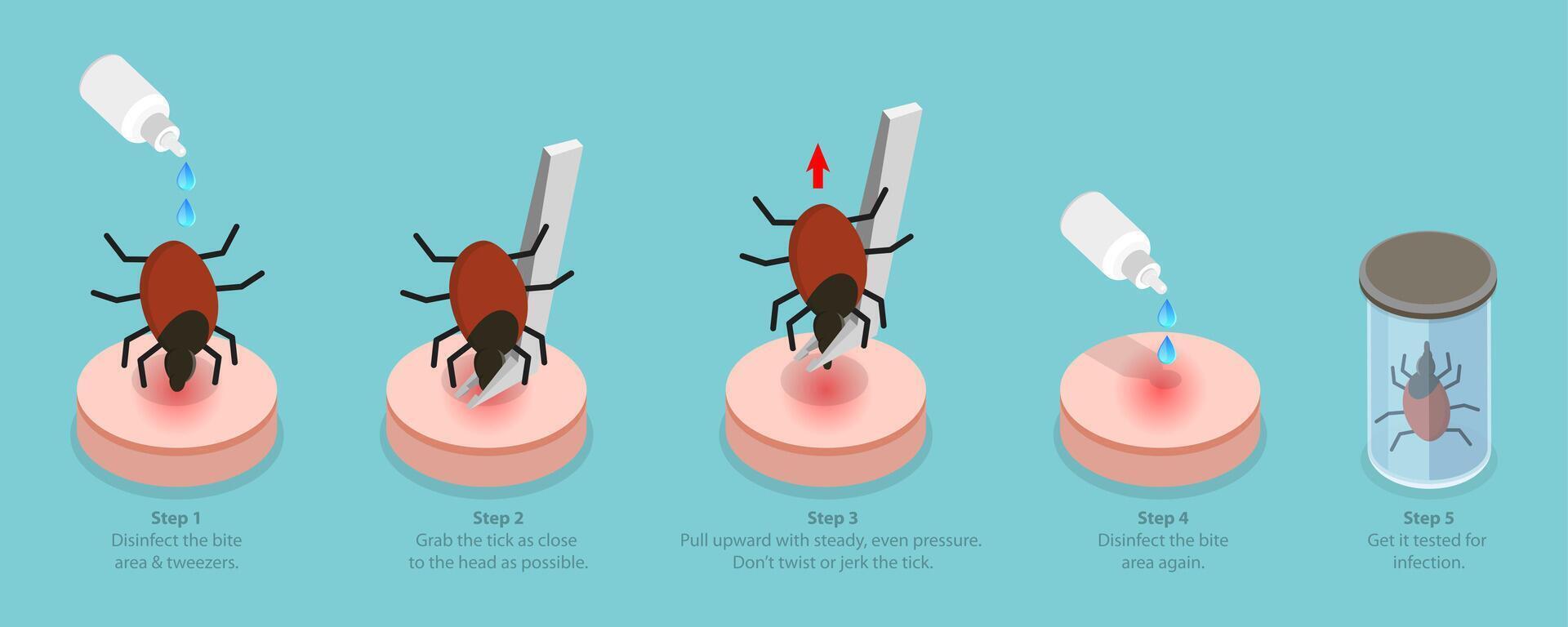 3D Isometric Flat Conceptual Illustration of How To Remove a Tick, A Parasite Carrying a Disease vector