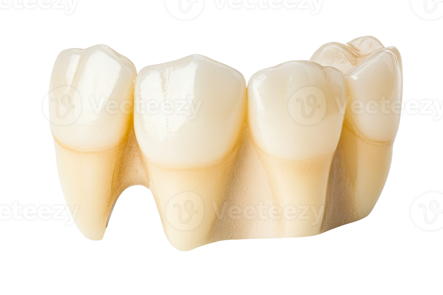 Realistic tooth design crown on transparent background png