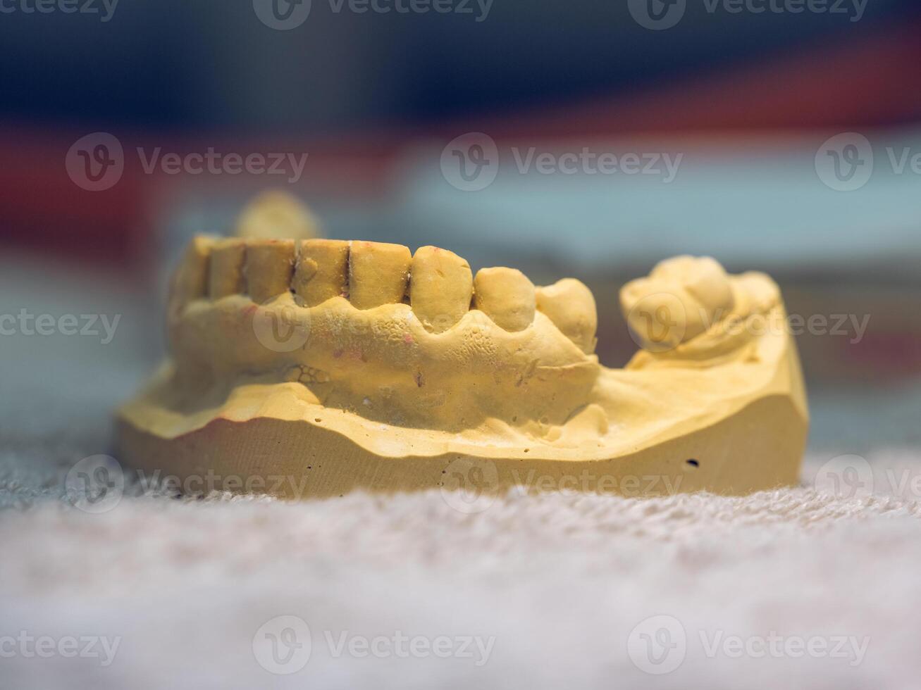 Gypsum cast of human jaw photo