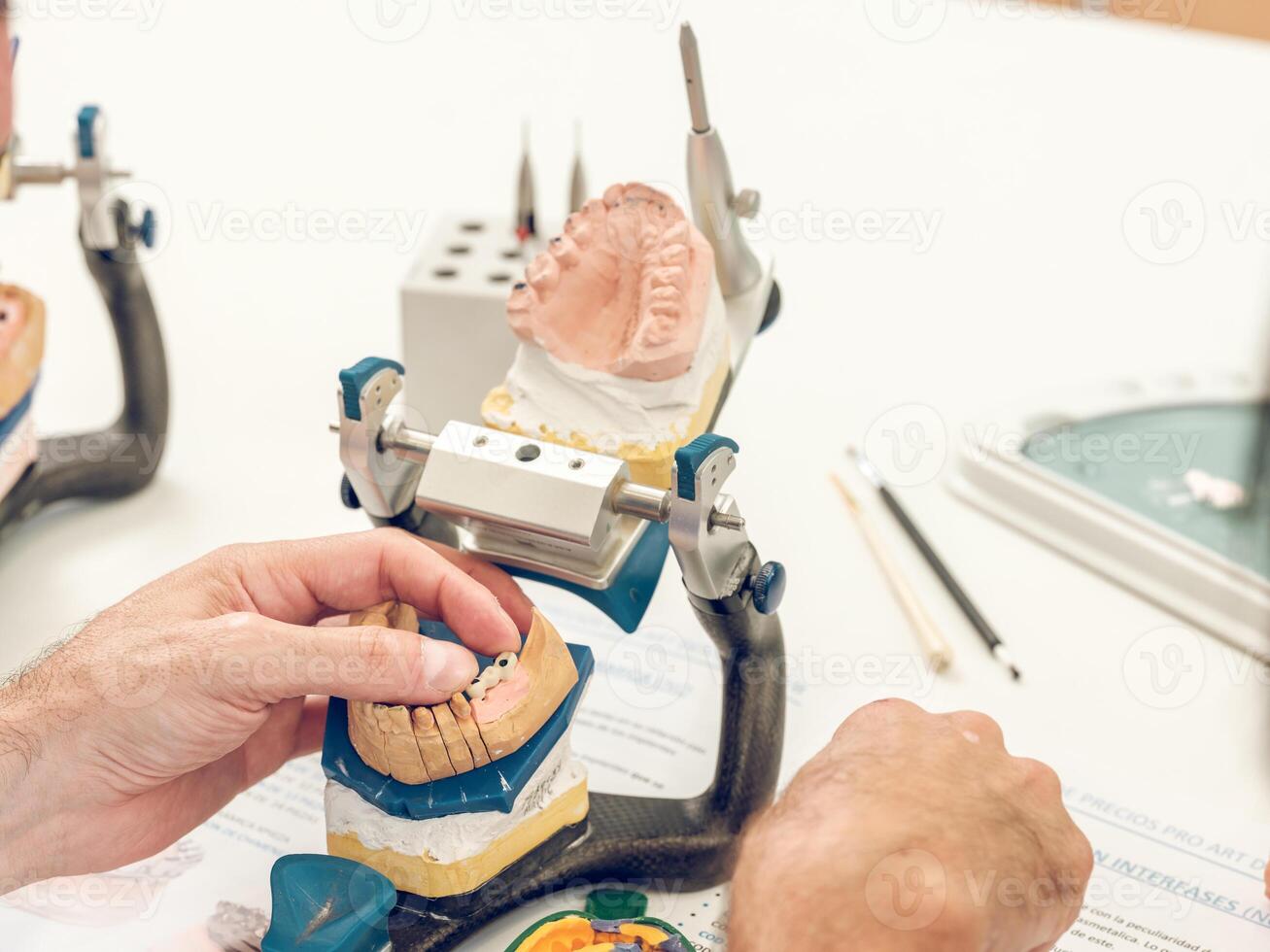 Crop dentist technician putting jaw casts on articulator photo