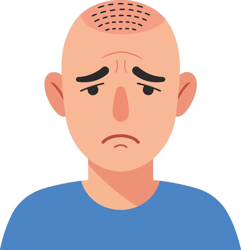 Bald man with a concerned expression wearing a blue shirt in a flat illustration style, depicting emotion and vulnerability in a simple design art vector