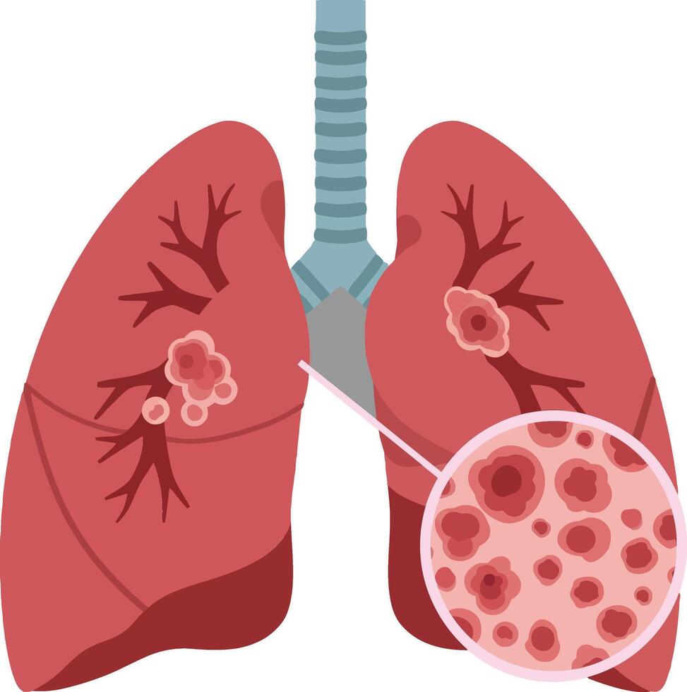 Detailed illustration of human lungs showcasing respiratory system with highlighted alveoli and bronchi in a flat design style for educational purposes art vector