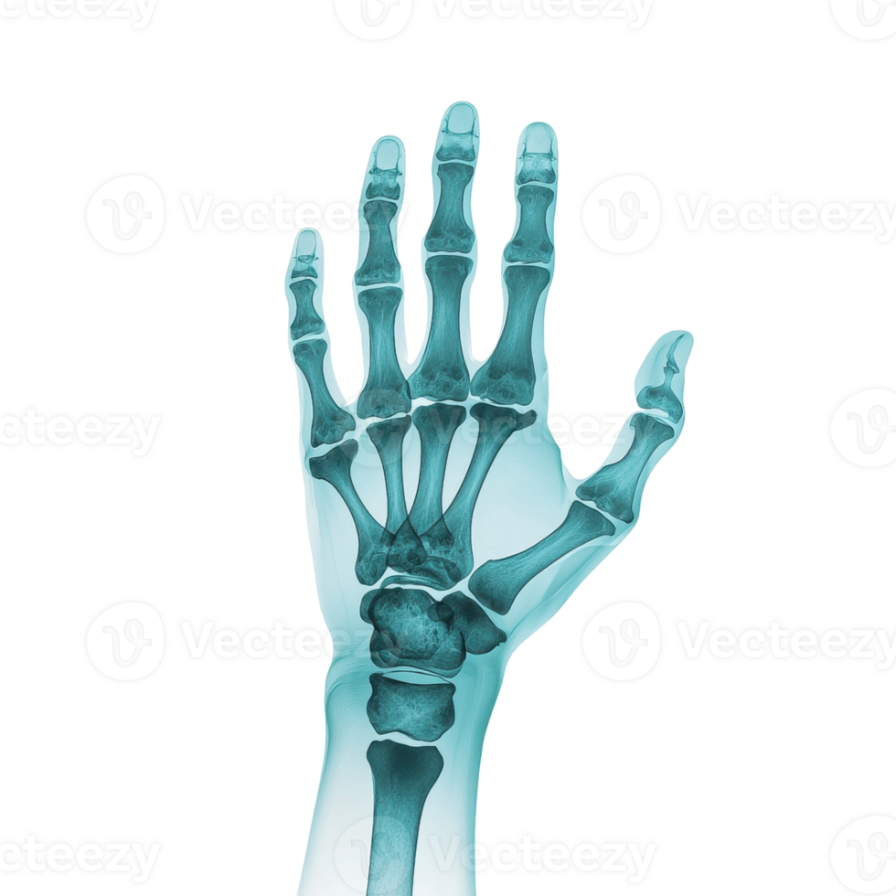 X ray of a human hand showing bones and joints. Medical imaging for diagnosis and treatment planning. png
