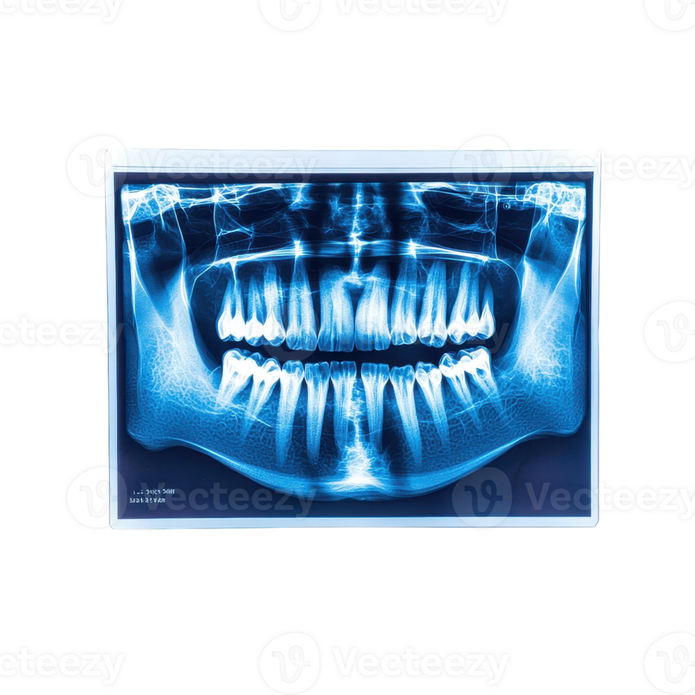 Panoramic dental X ray showing teeth and jawbone. Medical imaging for dental health and diagnosis. png