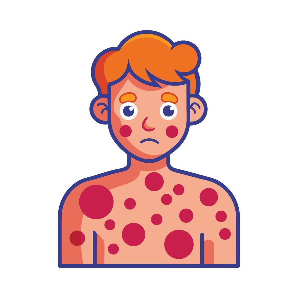 Bacteria Causing Severe Skin Rash and Irritation vector