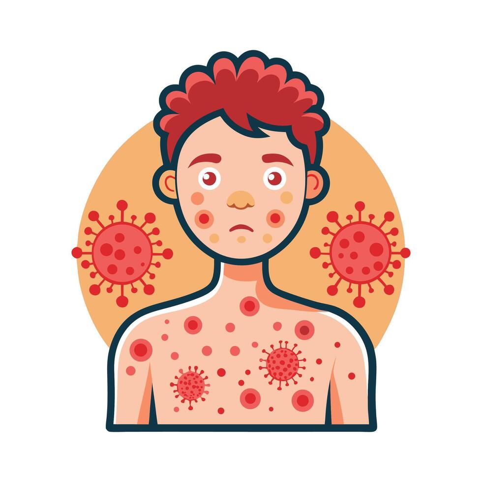 Severe Skin Rash and Irritation Caused by Bacteria vector