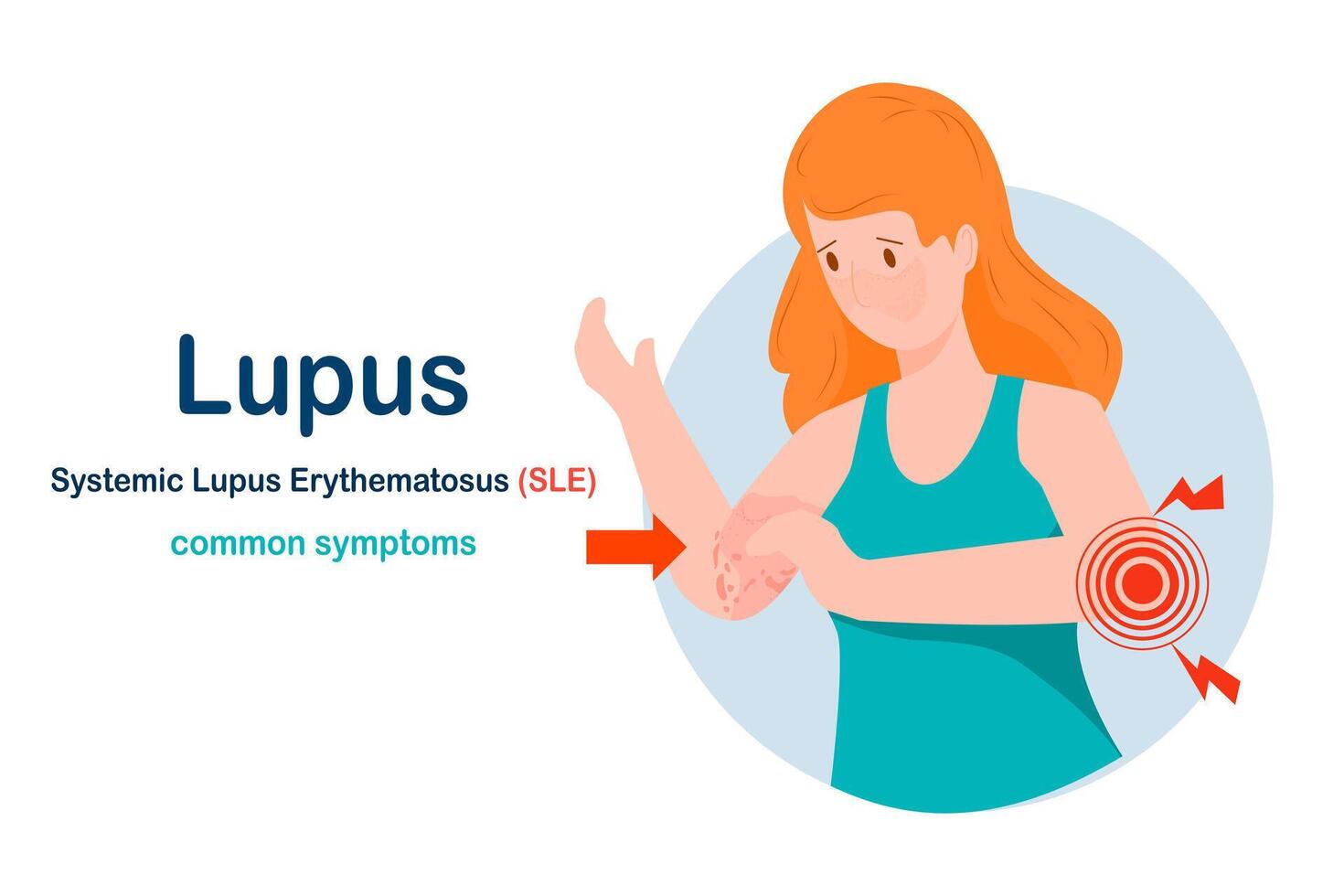 Common symptoms of lupus or SLE vector