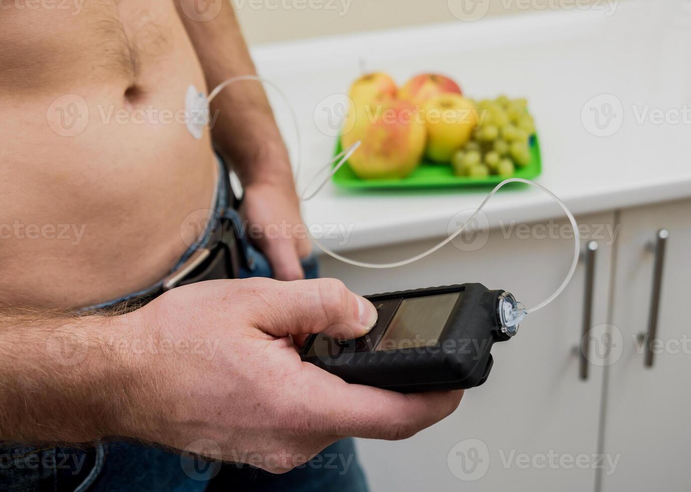 Diabetic man with an insulin pump connected in his abdomen. photo