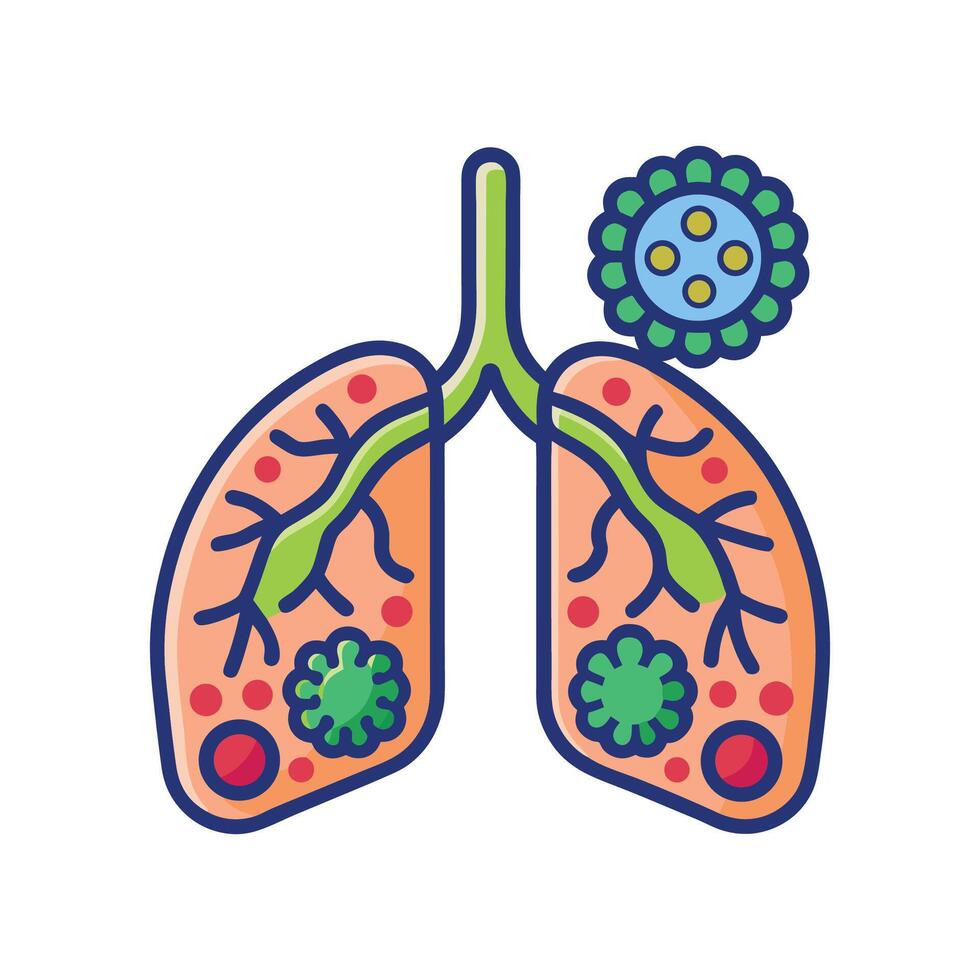 BacteriaInduced Pneumonia in Lungs vector
