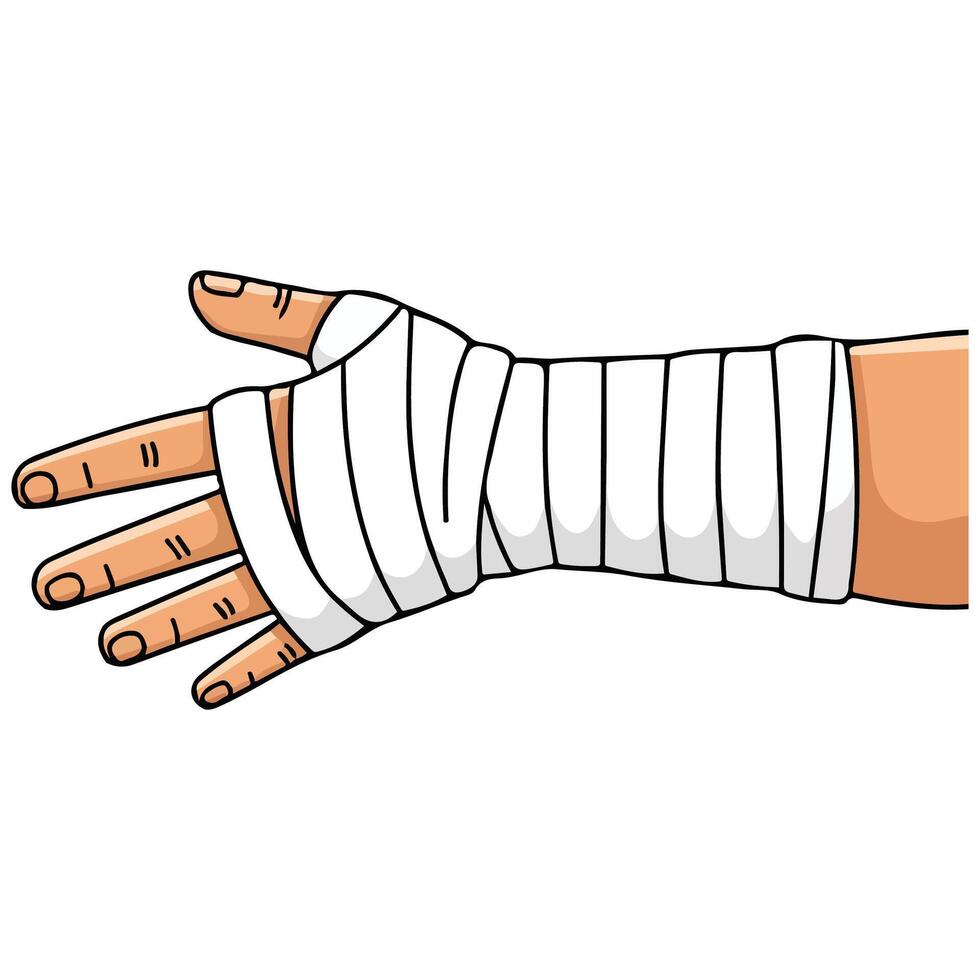Broken arm with cast vector