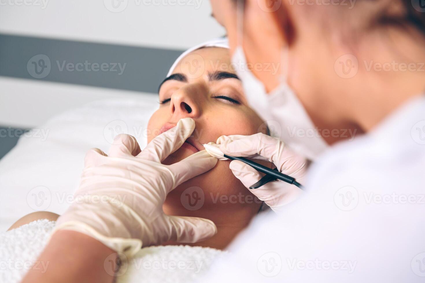 Woman getting rf lifting in her face in clinic photo