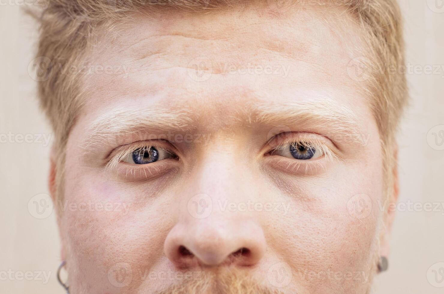 Close up portrait of an albino latino man photo