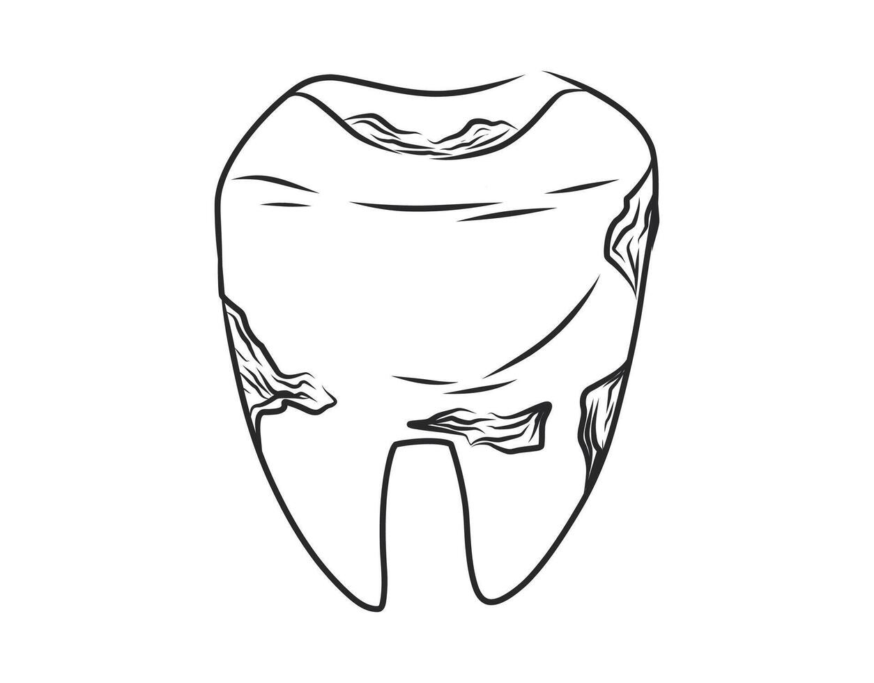 Hand-drawn illustration of a decayed tooth. Black and white sketch depicting tooth decay, dental cavities, and oral health problems. Medical, educational, and dentistry-related designs. vector