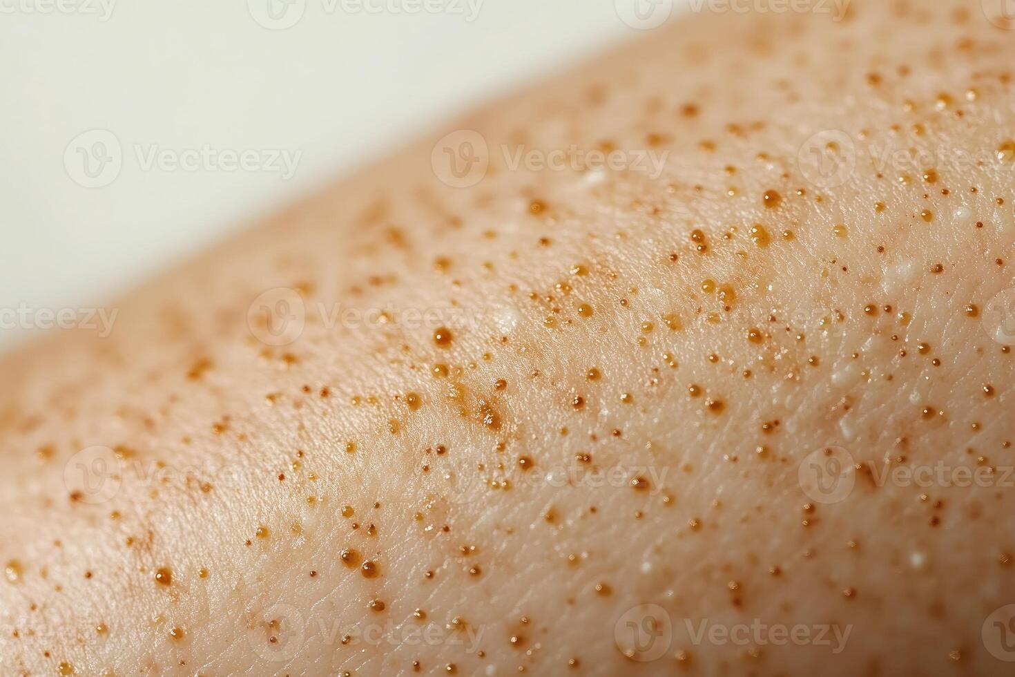 Close-up of skin with small brown and white dots photo