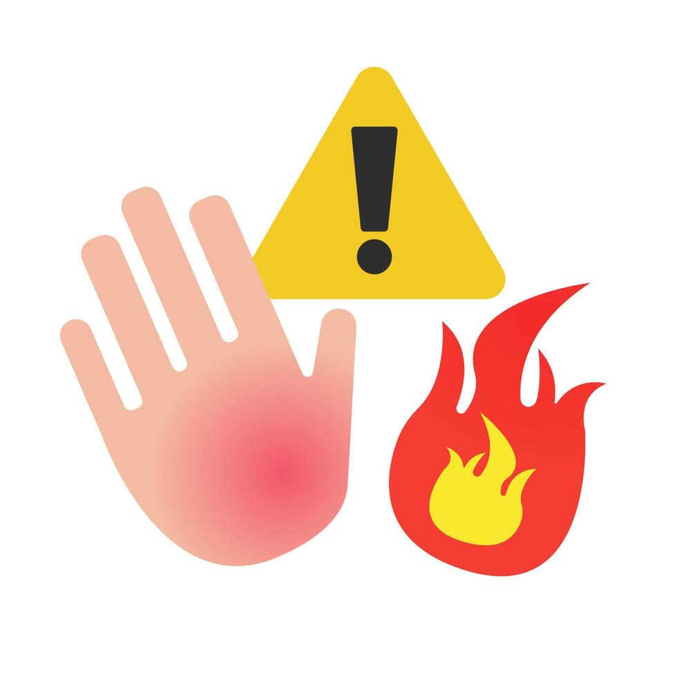 Hand burn warning icon. vector