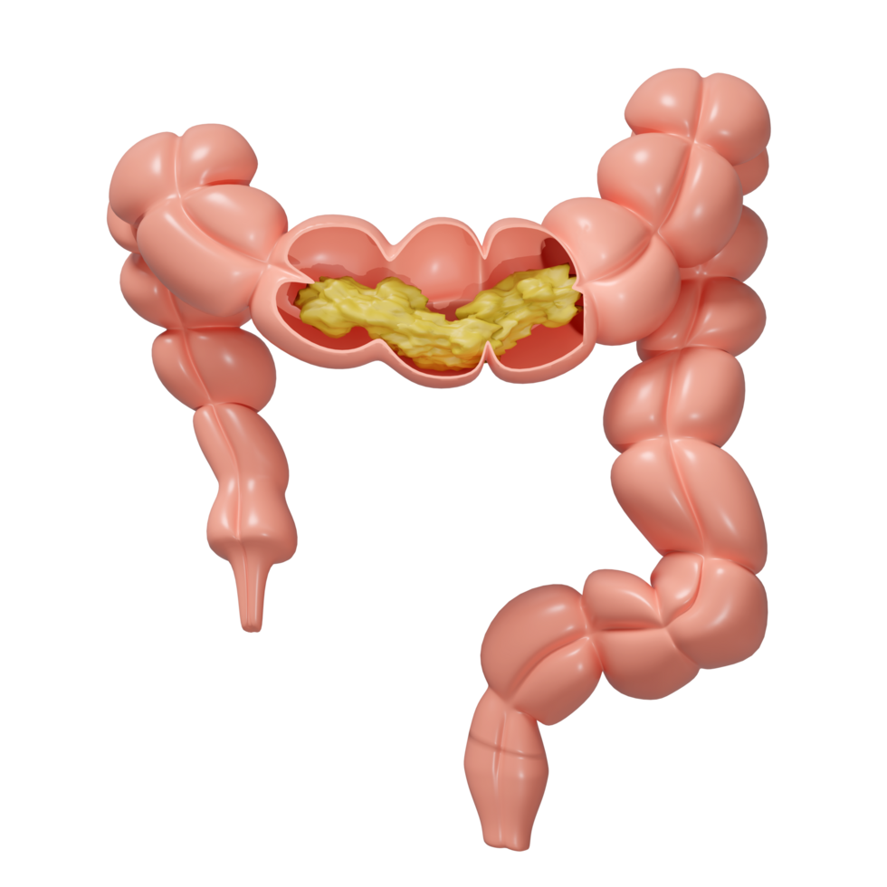 3d human colon cross section with waste in the intestine isolated. check colon health, constipation concept, 3d illustration render png