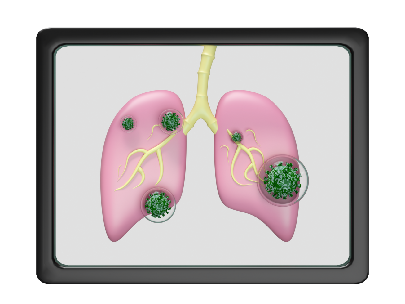 3d x ray film lung with virus isolated. world pneumonia day, check lung health, organs concept, 3d illustration render png