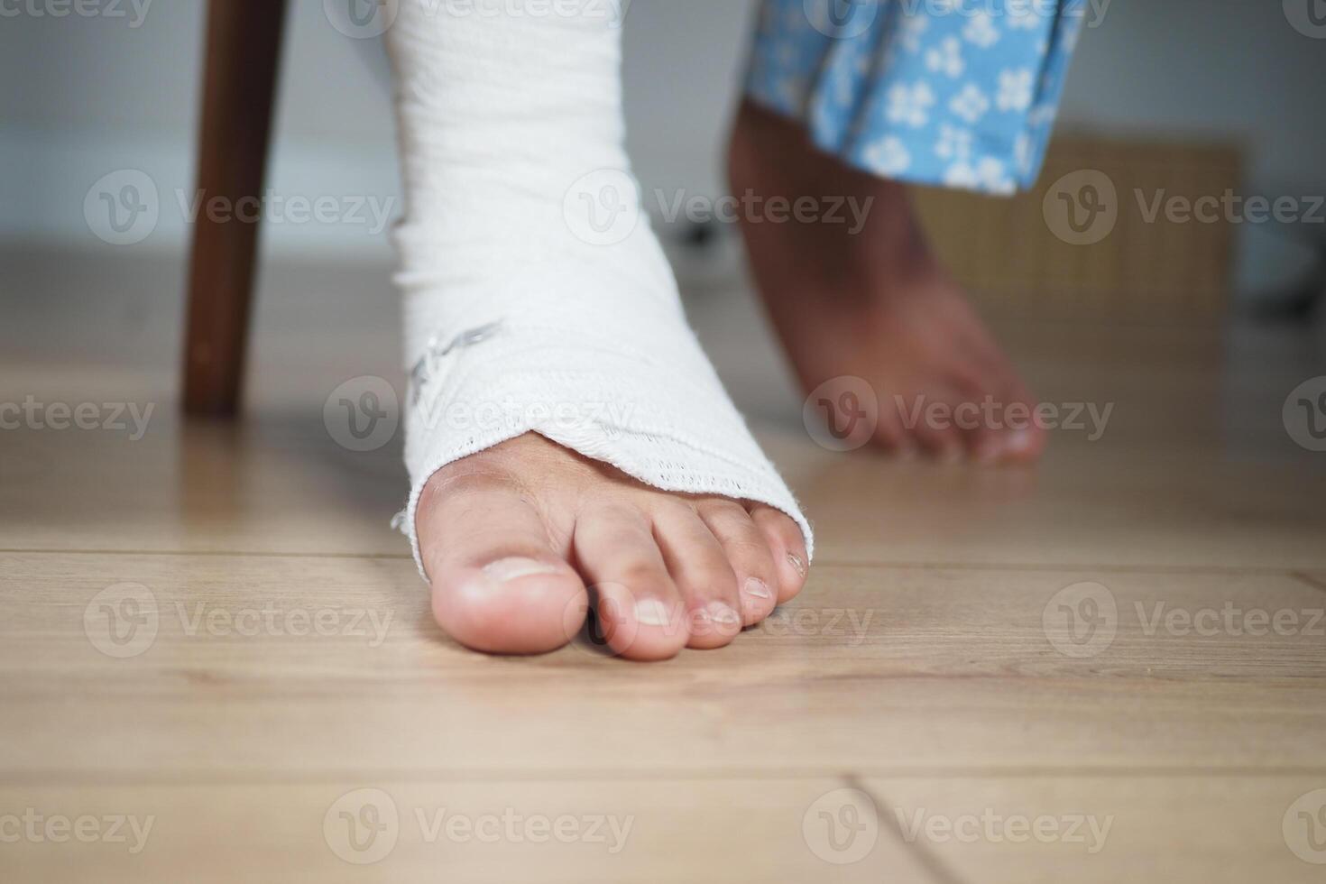 Bandaged foot nearing the floor shows recovery after injury photo