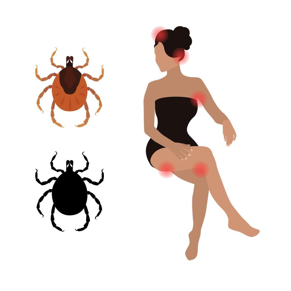 Woman showing skin rash and inflammation after being bitten by mite or tick, parasite causing several diseases like lyme disease or encephalitis, medical illustration vector