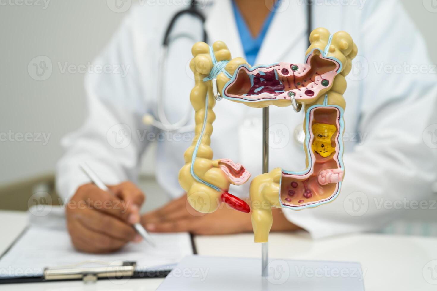 Intestine, appendix and digestive system, doctor holding anatomy photo