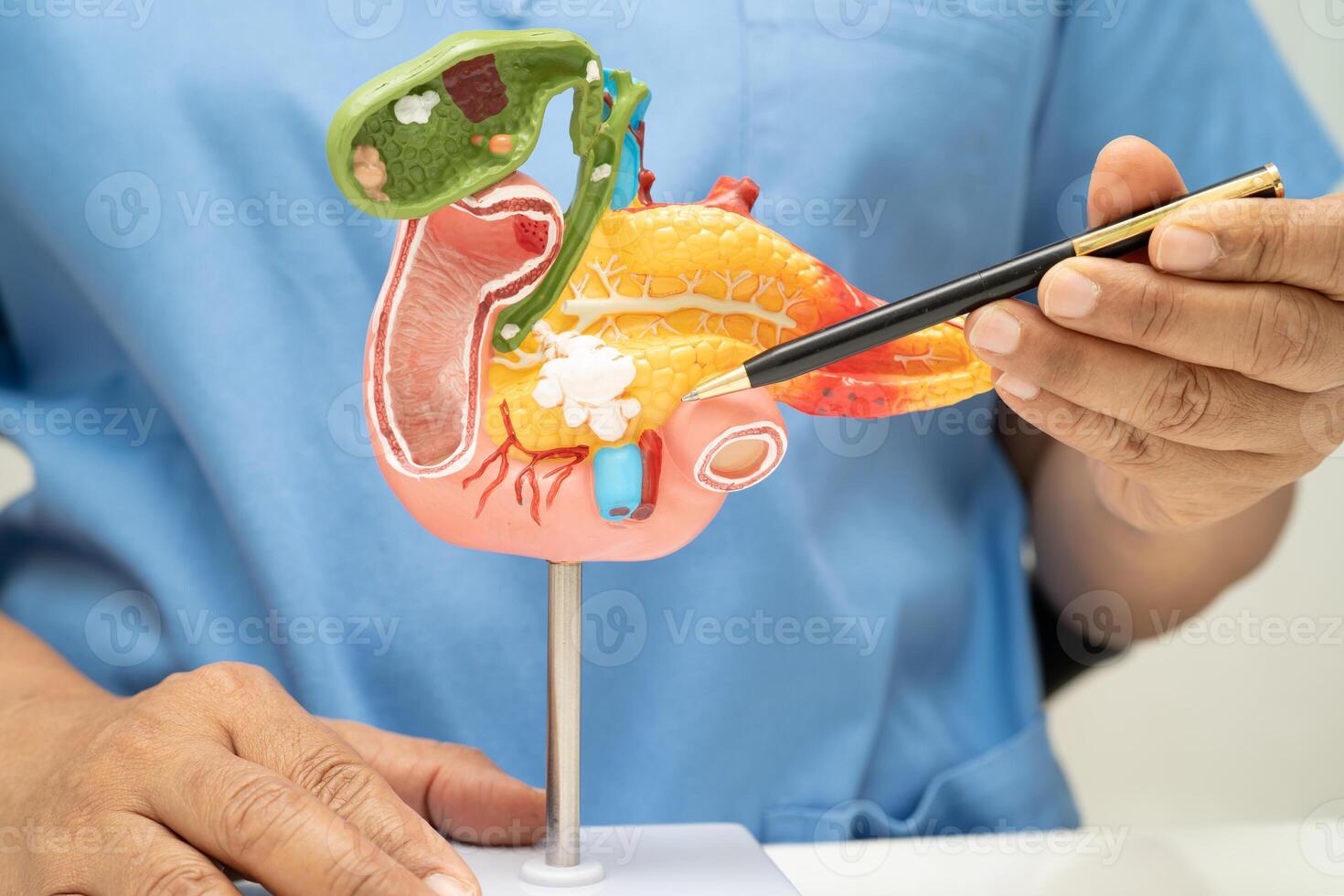 Pancreatitis, pancreatic cancer, Asian doctor with pancreas, gallbladder and bile duct photo