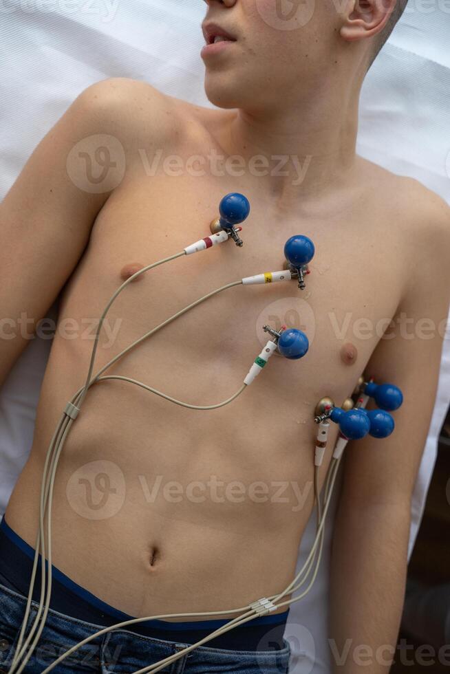 A female doctor performs an ECG on a young man in a hospital room, carefully monitoring his heart health during a routine checkup. photo