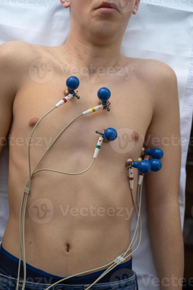 A female doctor performs an ECG on a young man in a hospital room, carefully monitoring his heart health during a routine checkup. photo