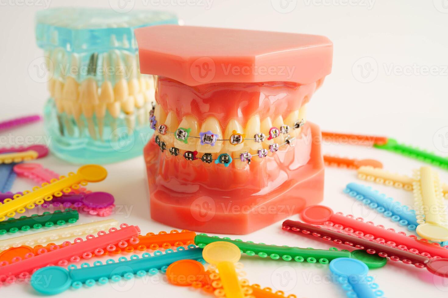 Orthodontic ligatures rings and ties, elastic rubber bands on orthodontic braces, model for dentist studying about denti photo