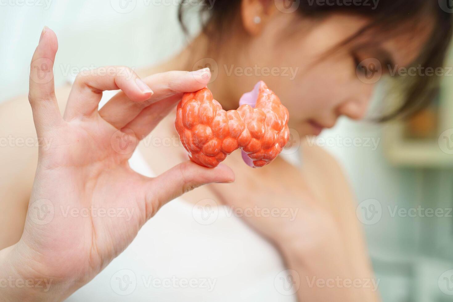 Hyperthyroidism, Overactive Thyroid, Thyroid Lymphoma, Asian woman with thyroid gland human ana photo