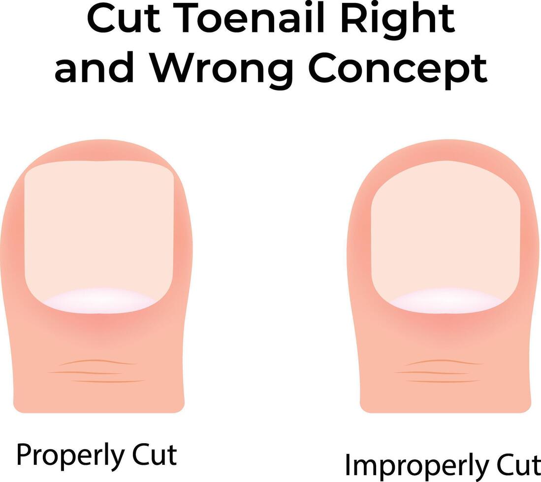 Proper and Improper Toenail Cutting Techniques Illustration vector