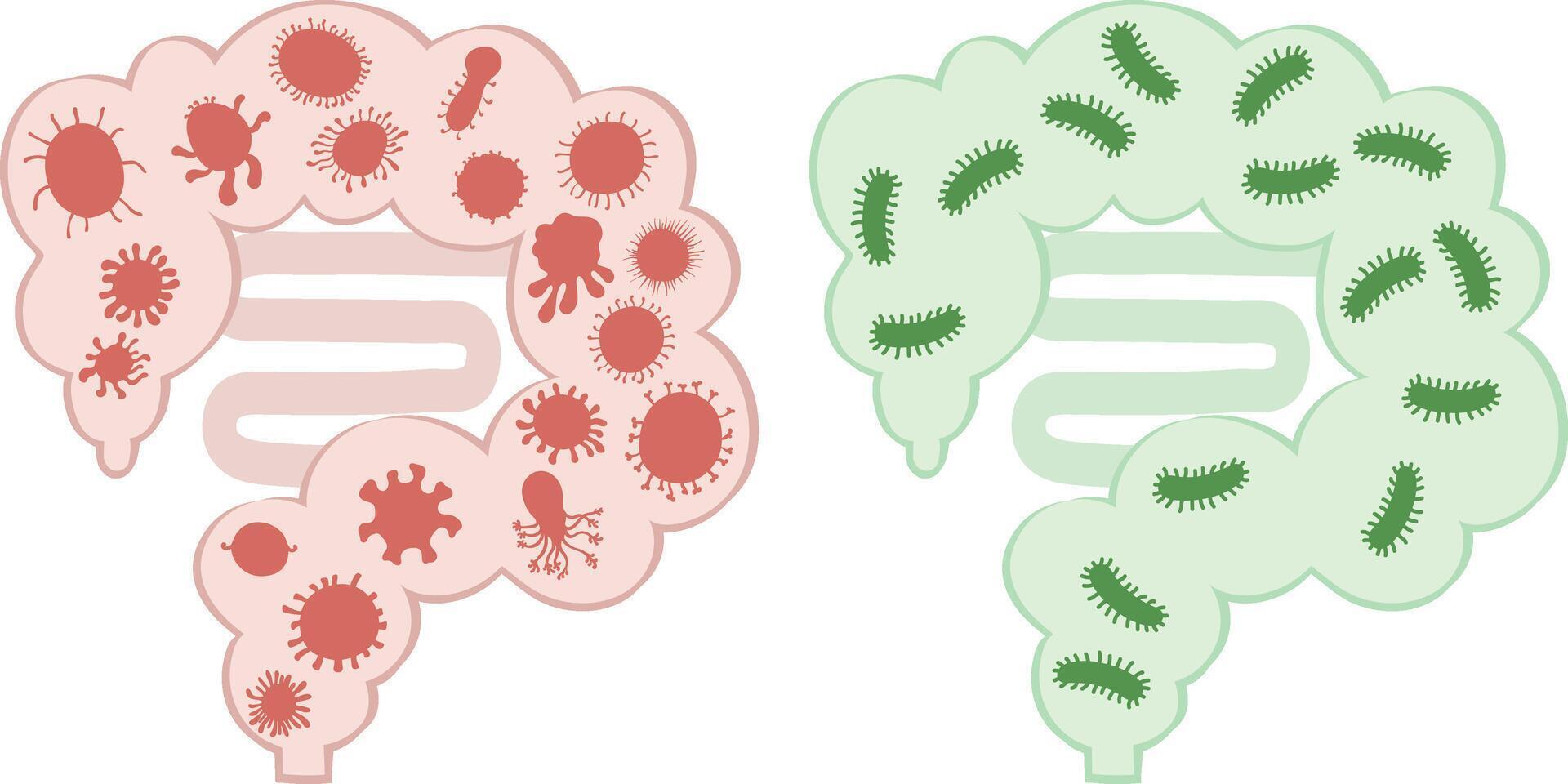 healthy intestine with beneficial bacteria and an unhealthy intestine with harmful bacteria vector