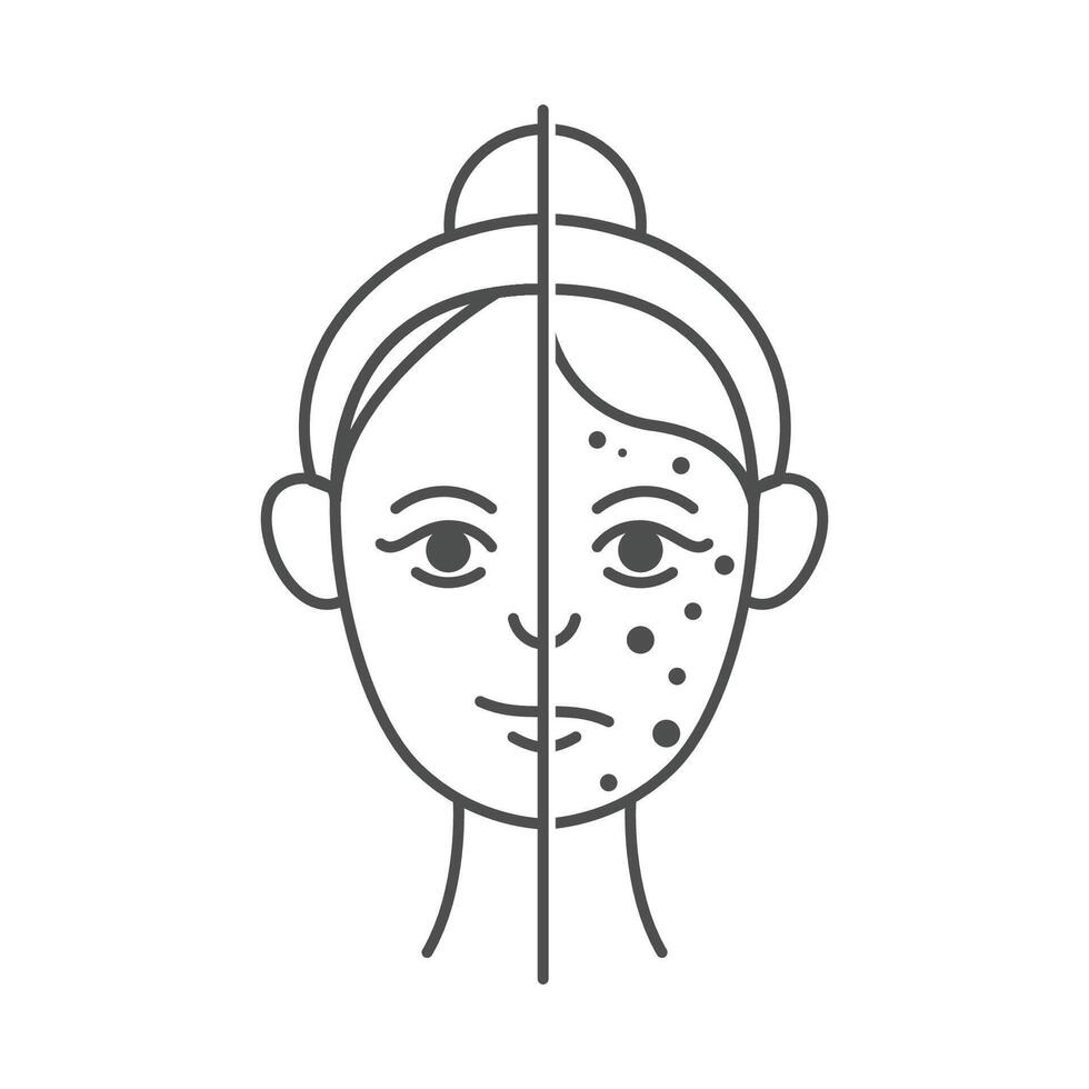 A woman with acne on her face and a white background vector
