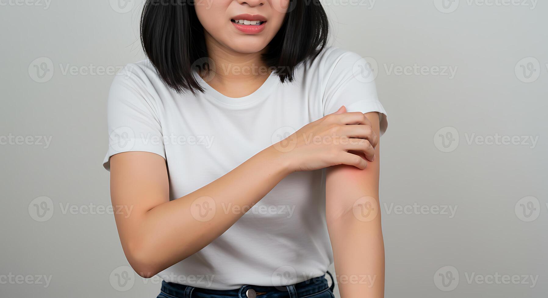 Asian woman with red rash on her arm photo