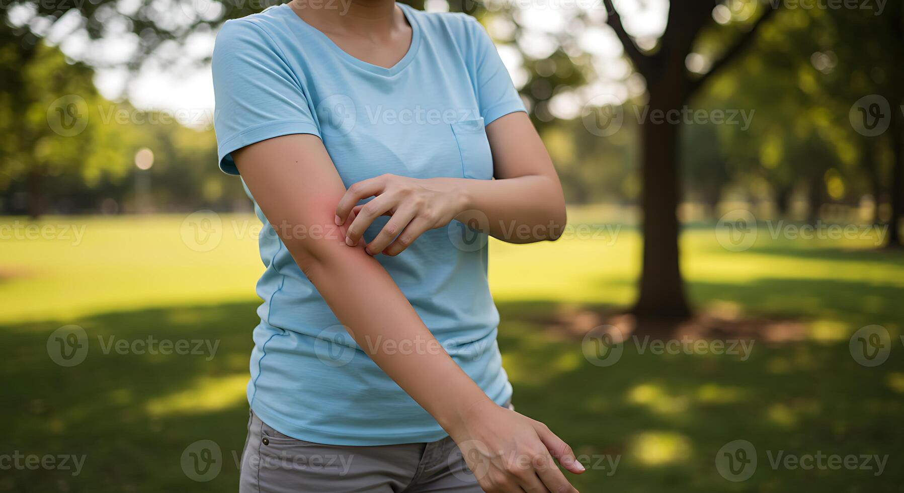 Woman Scratching Itchy Arm A Serene Outdoor Scene photo