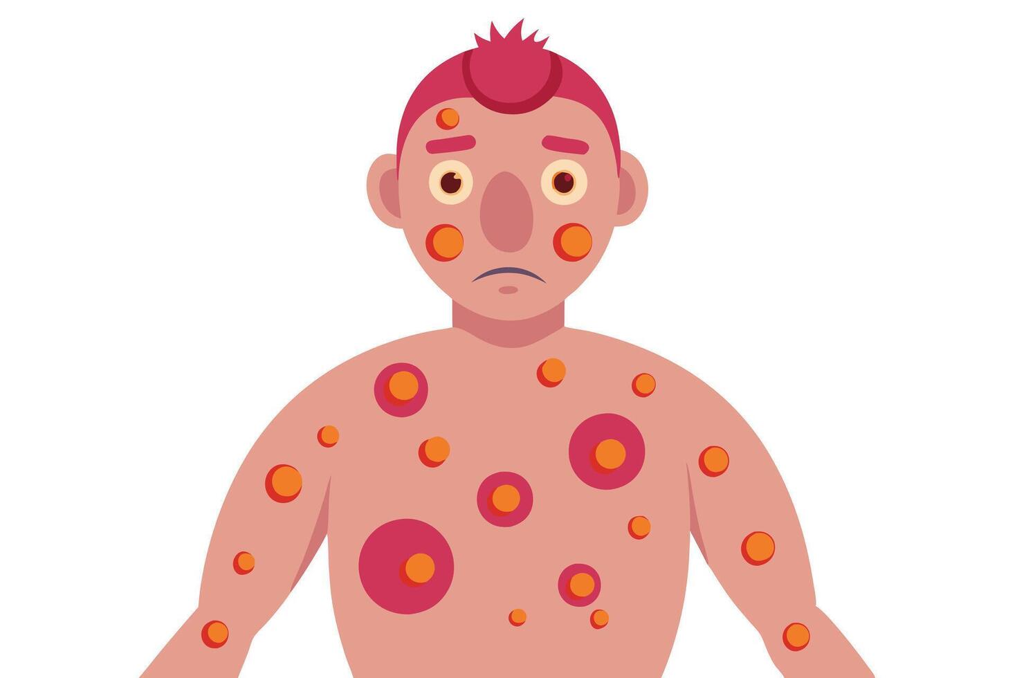 Sad Man with Skin Rash, Spots on Body, Red Hair, Pale Skin, White Background vector