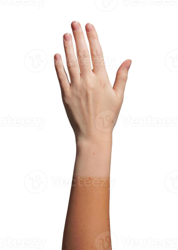 Hand with wrist showing sunburn and suntan contrast. Tan line from exposure to sunlight, fair skin photo