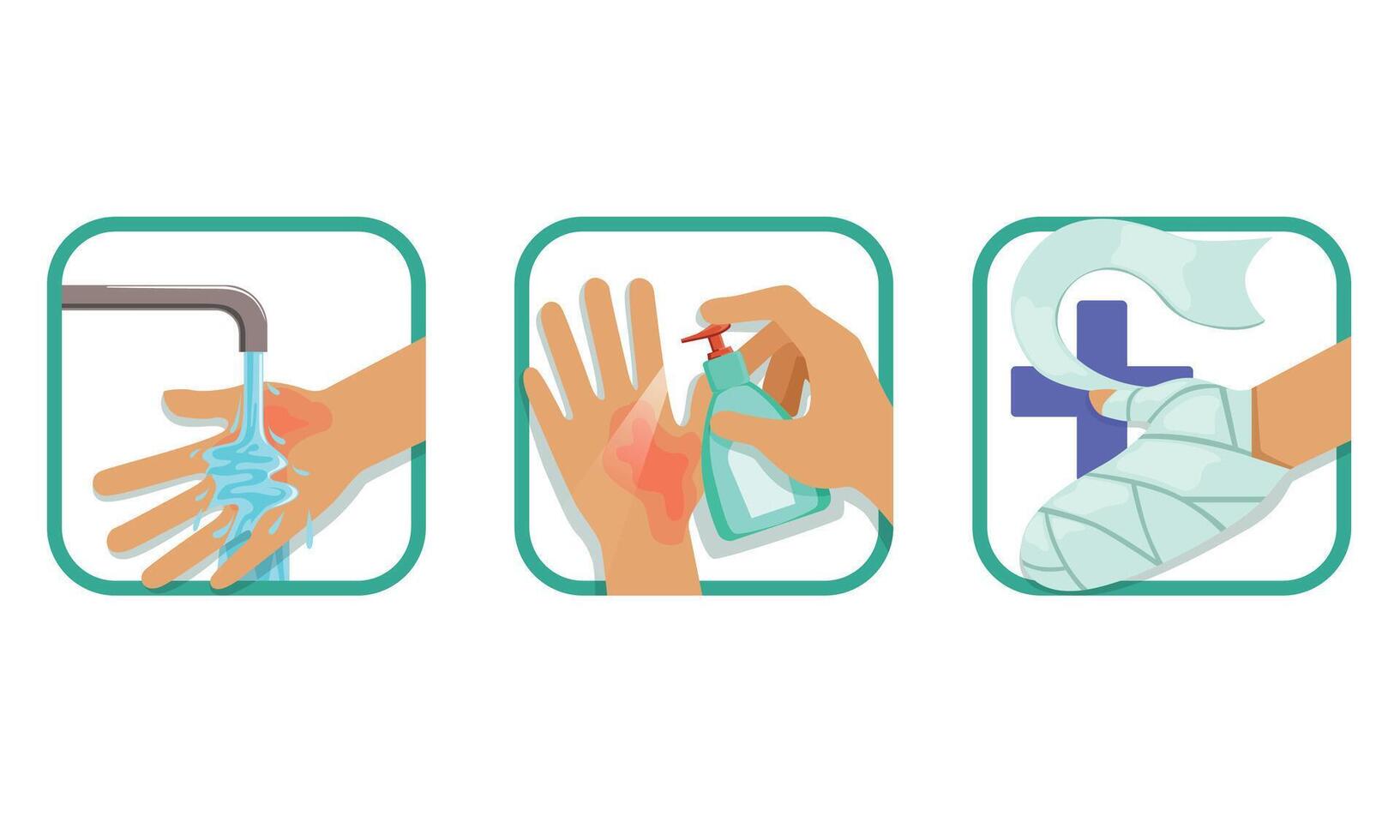 Skin Burn Injury Treatment Set, Treating Hand Injury with Water, Antiseptic, Bandaging, Brochure, Poster Infographic Element Illustration vector