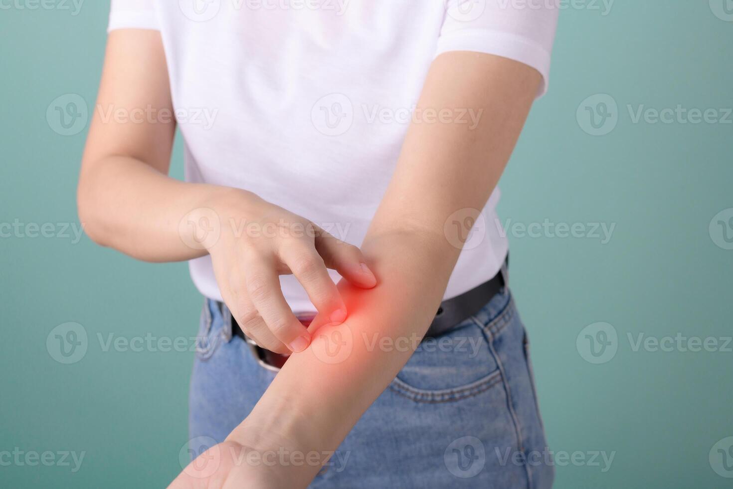 person scratching their irritated arm with red inflamed area, indicating skin irritation or allergic reaction photo