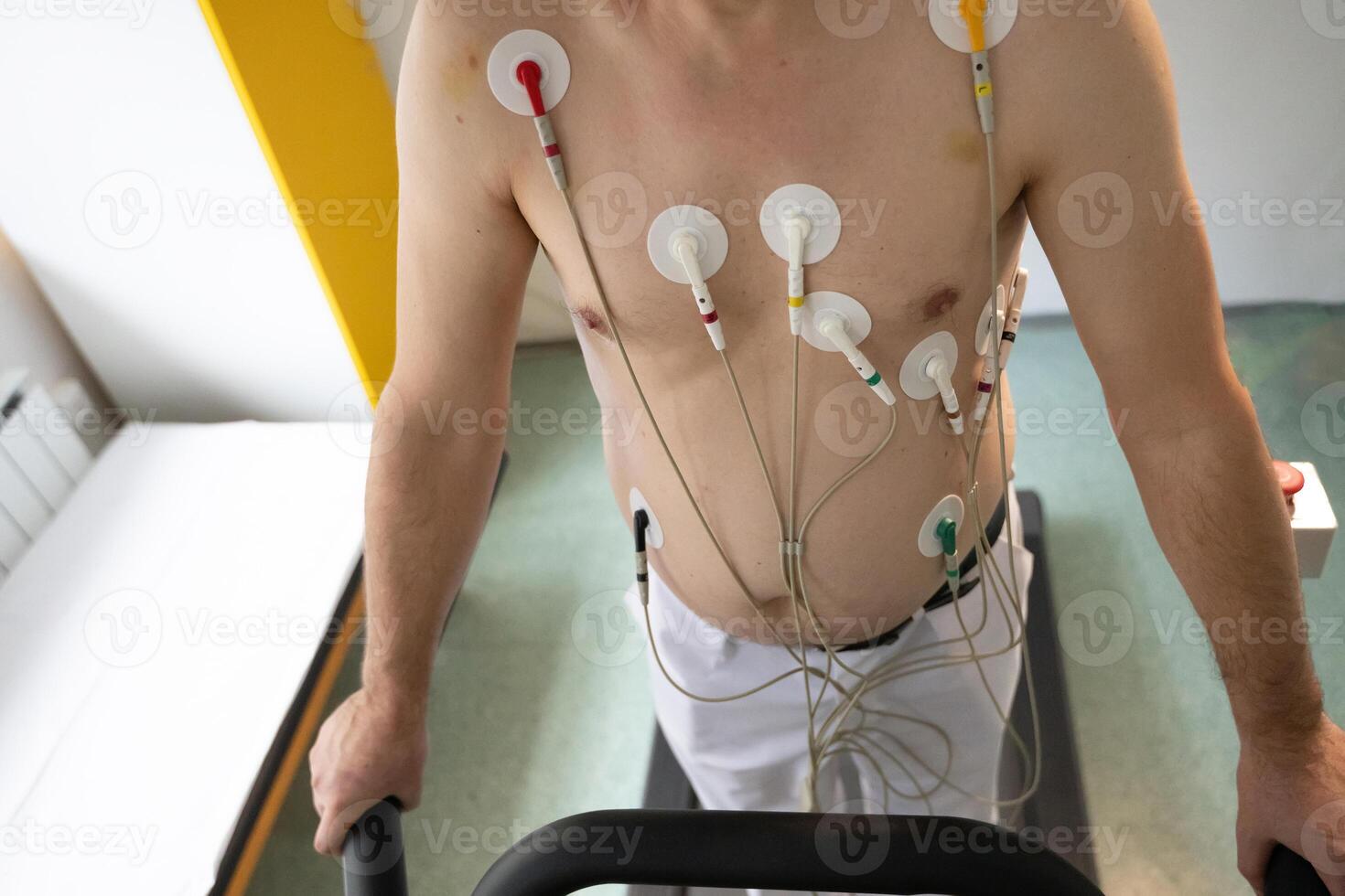 A middle-aged man is undergoing a medical stress test on a treadmill, connected to ECG electrodes for heart monitoring in a clinical environment photo