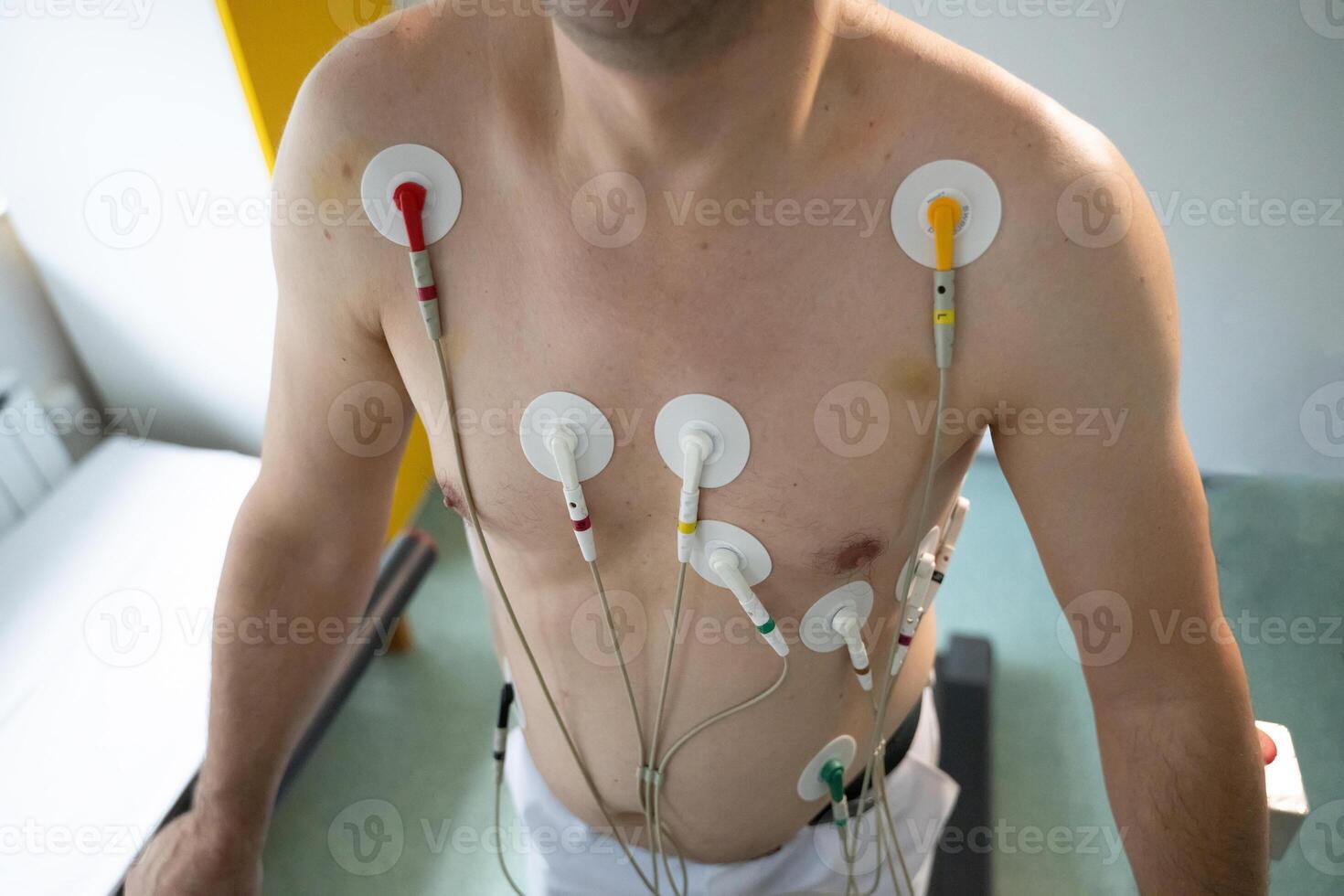 A middle-aged man is undergoing a medical stress test on a treadmill, connected to ECG electrodes for heart monitoring in a clinical environment photo